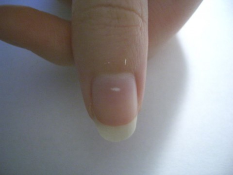 white-spot-on-fingernail how to build muscle